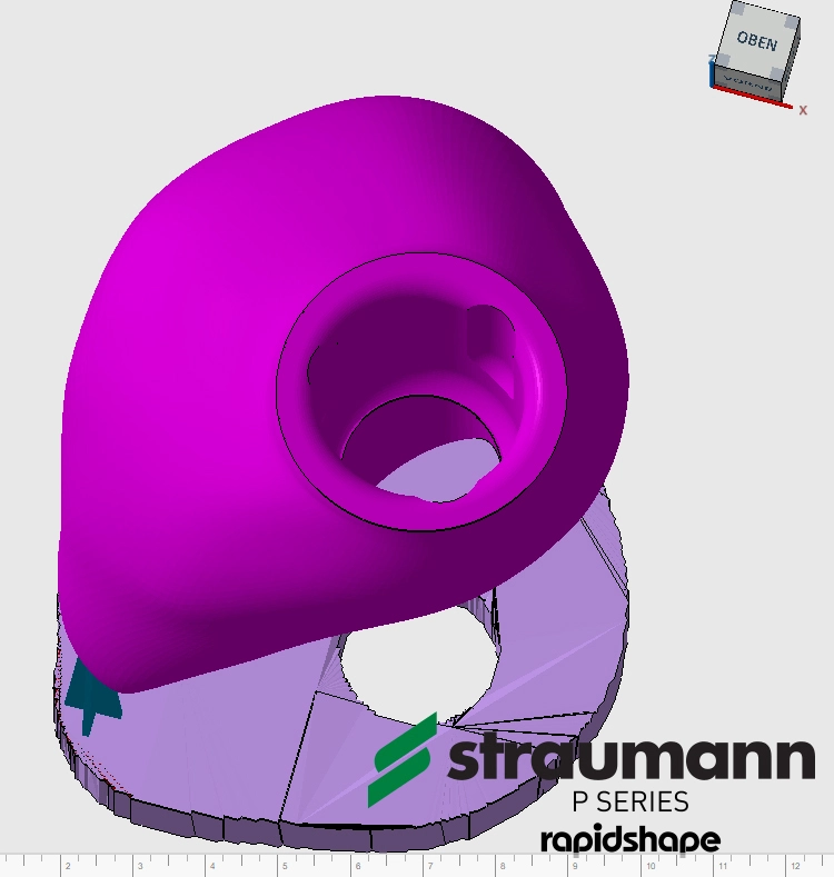 Abb. 18 und 19: Nesting der konstruierten Krone in der Software des 3D-Druckers (Netfab Slicing). Vorbereitung für den Druckprozess.