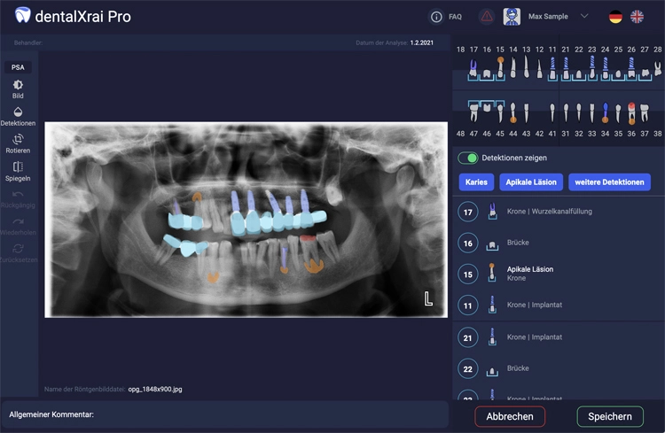 Abb. 1: Die Software dentalXrai ist in die Praxiskommunikationsplattform infoskop eingebunden und dort – vom Wechsel zwischen dem nativen und detektierten Röntgenbild über die Editierfunktion bis hin zum Download der Dokumentation – sehr einfach intuitiv zu bedienen.