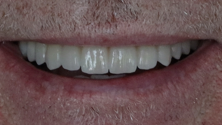 Abb. 21: Lippenbild.