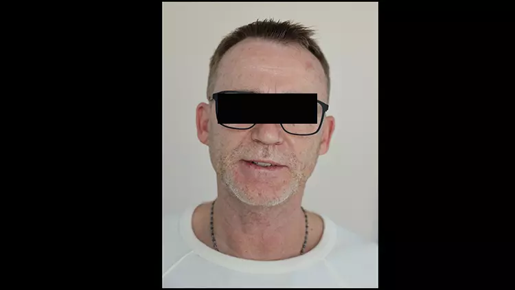 Abb. 22: Der zufriedene Patient.