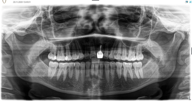 Abb. 2: Radiologische Ausgangssituation.