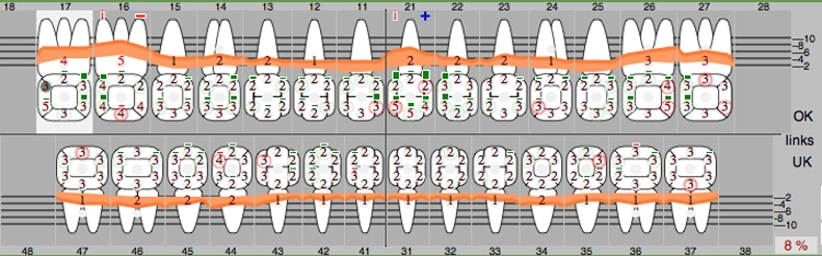 Abb. 3: Reevaluation sechs Wochen nach Full Mouth Scaling.