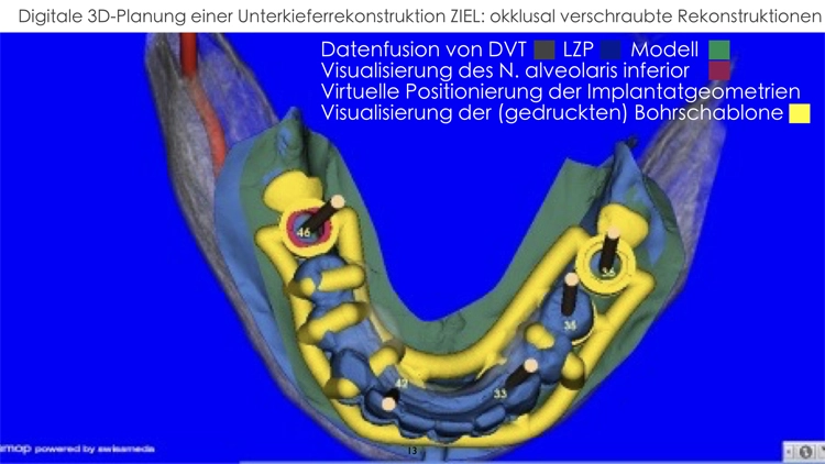 Abb. 4: Digitales 3D-Planungsmodell.