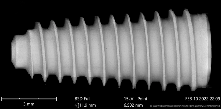 Abb. 4b: REM-Analysebild eines AnyRidge-Implantats.