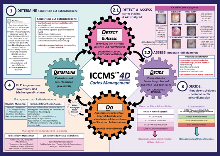 Abb. 5: Übersicht zu wesentlichen Aspekten des Kariesmanagementprozess(„Determine“, „Detect“, „Decide“, „Do“) im Rahmen des „International Caries Classification and Management System“ (ICCMS).