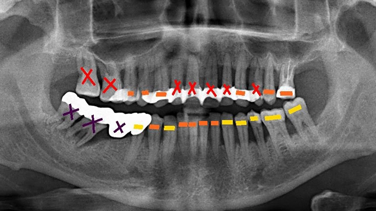 Abb. 7: Ausgangssituation des Patientenfalls.