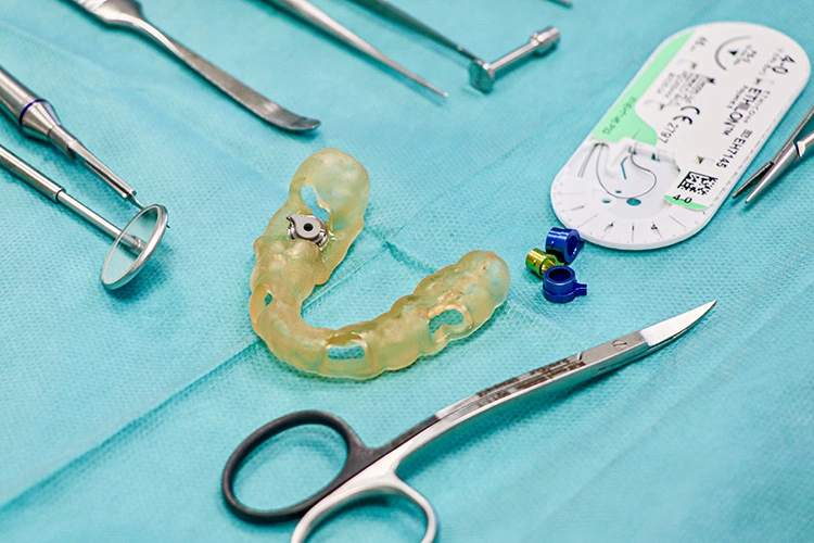 Abb. 7: „Smile-in-a-Box“ -Bohrschablone für die navigierte Implantation mit entsprechenden Reduzierhülsen.