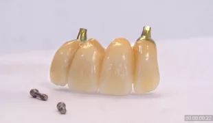 .