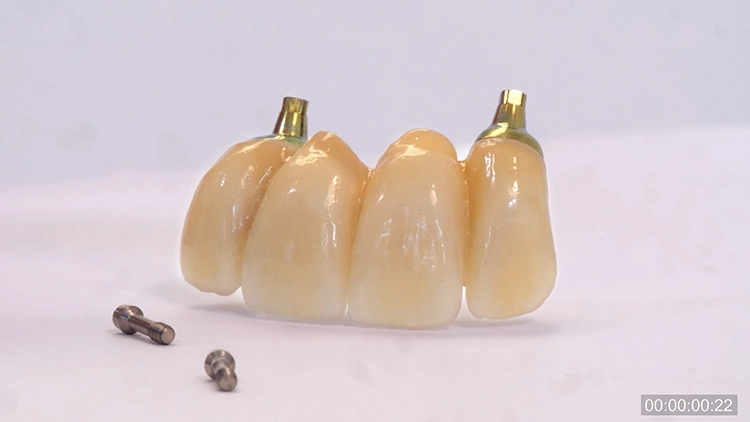 Abb. 8: Von außen sind die EAP® Abutments nicht von einem Titan-Abutment zu unterscheiden.