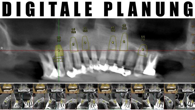 Abb. 8a: Die digitale Planung.