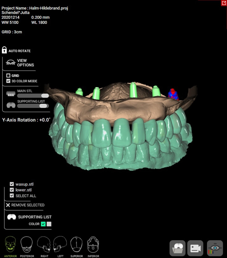 Abb. 9a: 3D-Animation zur Planung.