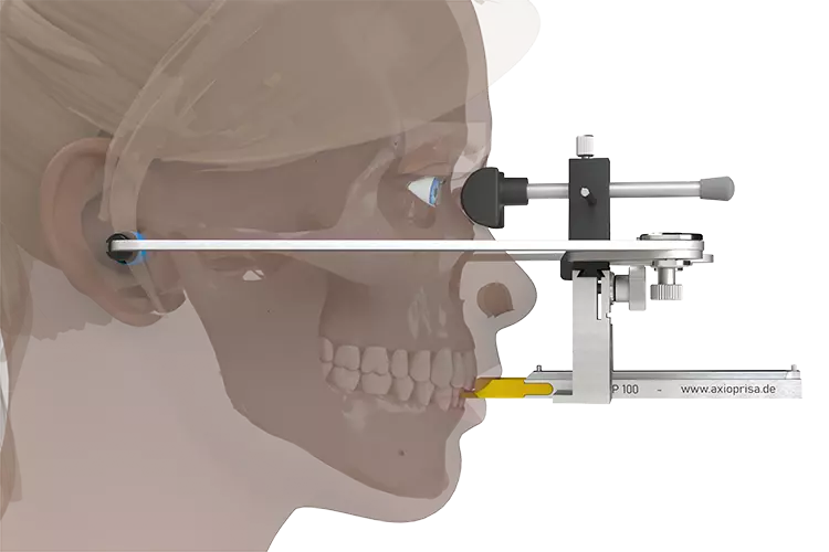 Abb. 2: Der AxioPrisa Bissgabelträger kann per Intraoralscanner erfasst werden.