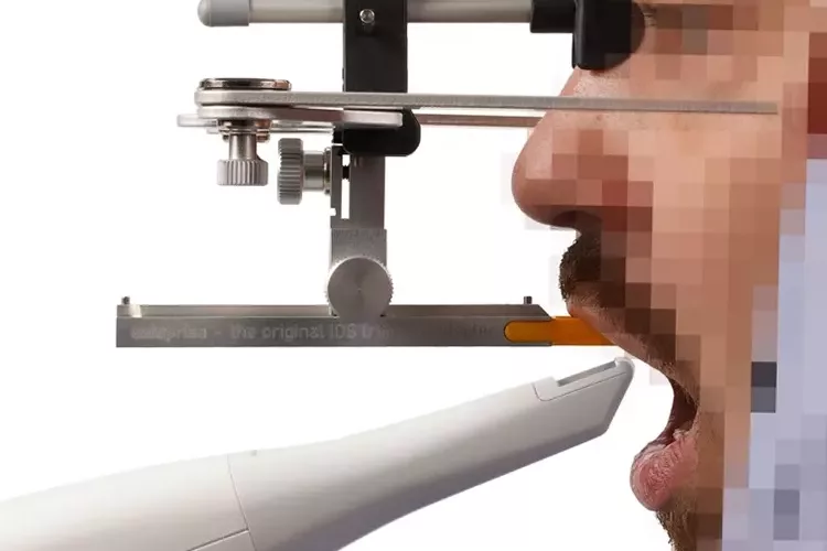 AxioPrisa – der angelegte herkömmliche Gesichtsbogen AxioQuick mit dem neuen AxioPrisa Bissgabelträger.
