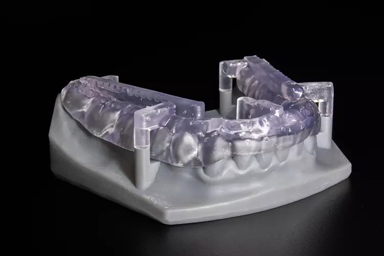 Abb. 1: Passgenauigkeit: Schiene aus Dental LT Clear V2. Die CAD-Konstruktion wird 1:1 wiedergegeben.