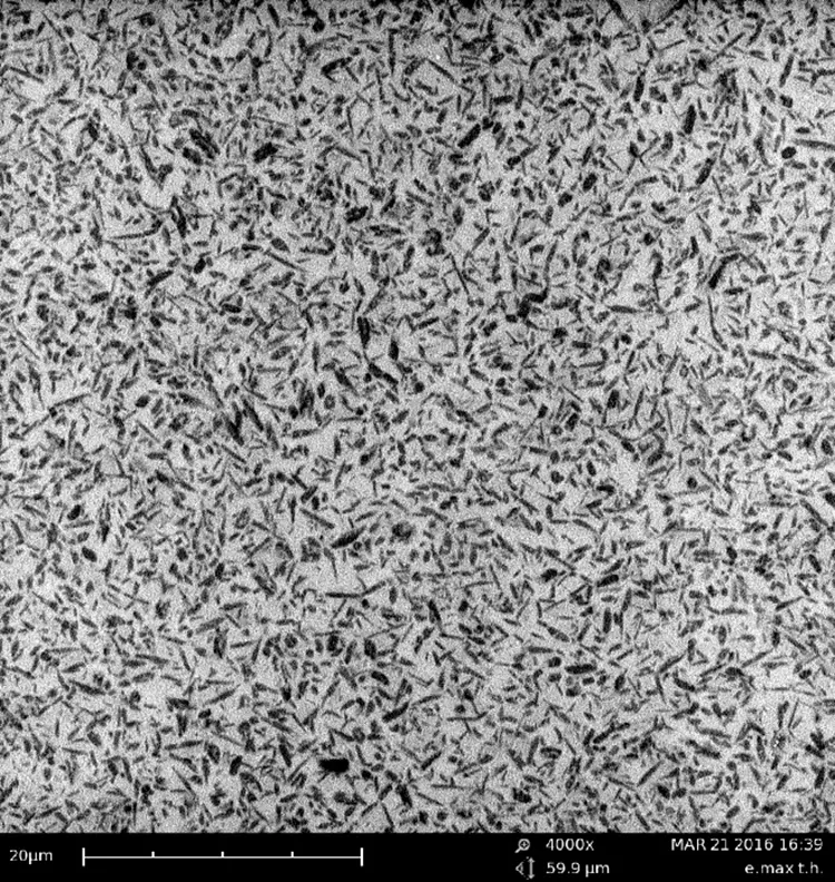 Abb. 1: Materialdifferenzierte rasterelektronenmikroskopische Aufnahme (4000x) einer glaskeramischen Oberfläche. Deutlich sichtbar ist die Struktur der Glaskeramik. Gut erkennbar sind die kristallinen Bereiche (dunkel), die in der Glasmatrix (hell) eingebettet sind. Die Kristalle sind zur „Verstärkung“ der Keramik gedacht und liegen in unterschiedlichen Größen, Formen und Ausrichtungen vor.