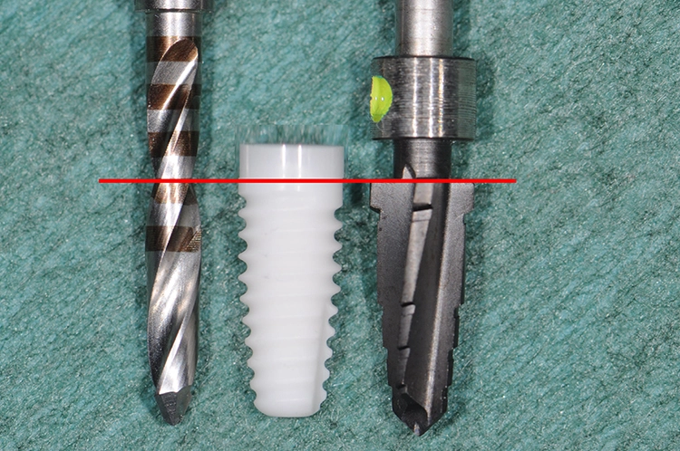 Abb. 10: Profilbohrer analog Implantatgeometrie.