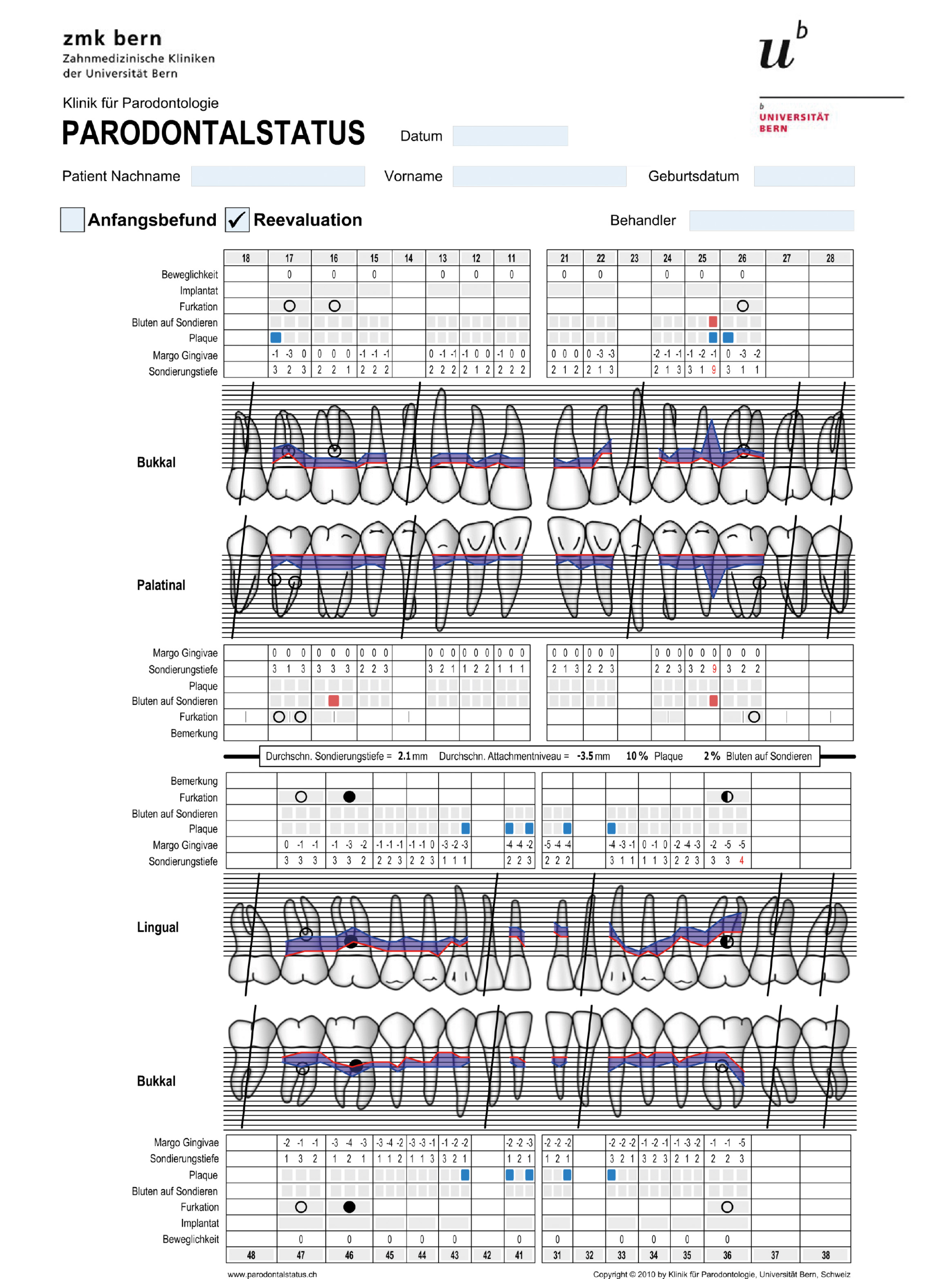 Abb. 14: Parodontaler Status 4 Jahre nach Therapiebeginn und 1 Jahr nach Abschluss der Kieferorthopädie.