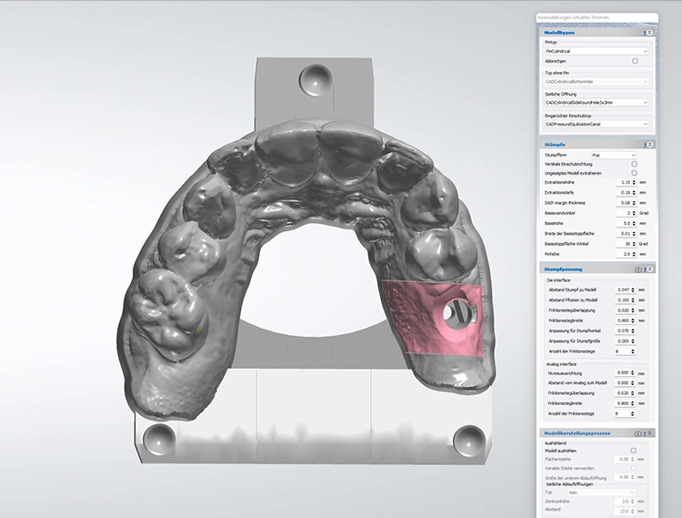 Abb. 1: Für alle gängigen 3D-Drucker gibt es softwareseitig in 3Shape und exocad validierte Parameter, die hochwertige Modelle ermöglichen.