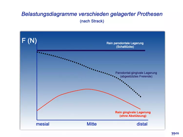 Abb. 1: Belastungsdiagramm verschieden gelagerter Prothesen nach Strack.