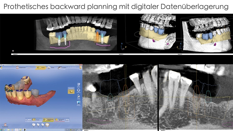 Abb. 1a: Datenmatch zum virtuellen Planungsmodell.
