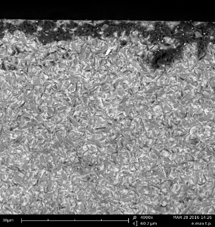 Abb. 2: Topografiedifferenzierte rasterelektronenmikroskopische Aufnahme (4000x)
einer glaskeramischen Oberfläche. Hauptsächlich ist eine homogene glaskeramische Struktur (hell mit kristallinen Bereichen) erkennbar. Am oberen Bildrand (dunkle Bereiche) weicht die Struktur unverkennbar ab. Hier ist die Topografie der Probe durch Einlagerungen und Beschädigungen verändert.