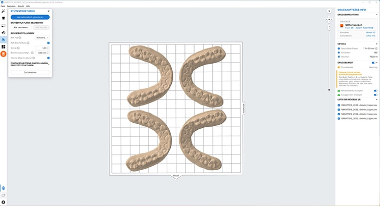 Abb. 3: Ausrichtung der Scandaten auf der Bauplattform und Vorbereitung der Druckdaten in der Slicing Software.
