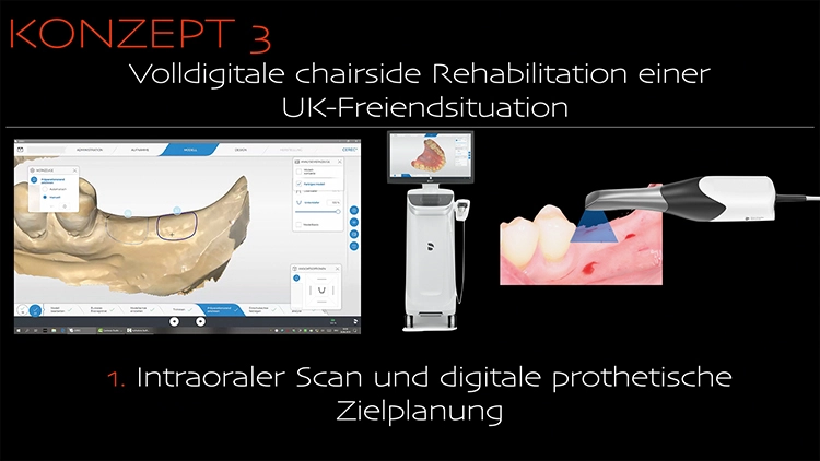 Abb. 3a: Intraoraler Scan und digitale prothetische Zeitplanung.