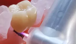 Plasma.