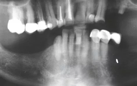 Abb. 5: Postoperative Nachkontrolle.