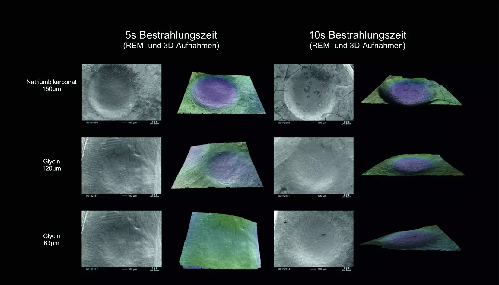 Abb. 7: Rasterelektronenmikroskopische Aufnahmen von humanen Dentinproben nach der Behandlung mit unterschiedlichen Strahlmedien [23]. Die Plättchen wurden in einem Abstand von jeweils 2 mm in einem Winkel von 90° mit einem Druck von 2,5 bar für 5–10 Sekunden bestrahlt. Vor allem in der dreidimensionalen Darstellung lassen sich die unterschiedlichen Effekte der Pulver und Korngrößen deutlich erkennen.