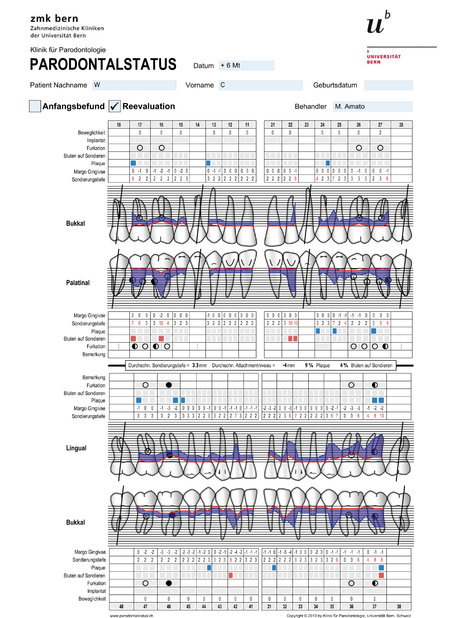 Abb. 7: Die Befundevaluation mit einem Parodontalstatus 6 Monate nach nichtchirurgischer Therapie zeigte
Verbesserungen. Allerdings lagen noch einige erhöhte Sondierungstiefen ≥ 6 mm vor. Basierend auf diesem
Befund erfolgte die weitere Therapieplanung. Nun waren parodontalchirurgische Eingriffe indiziert.