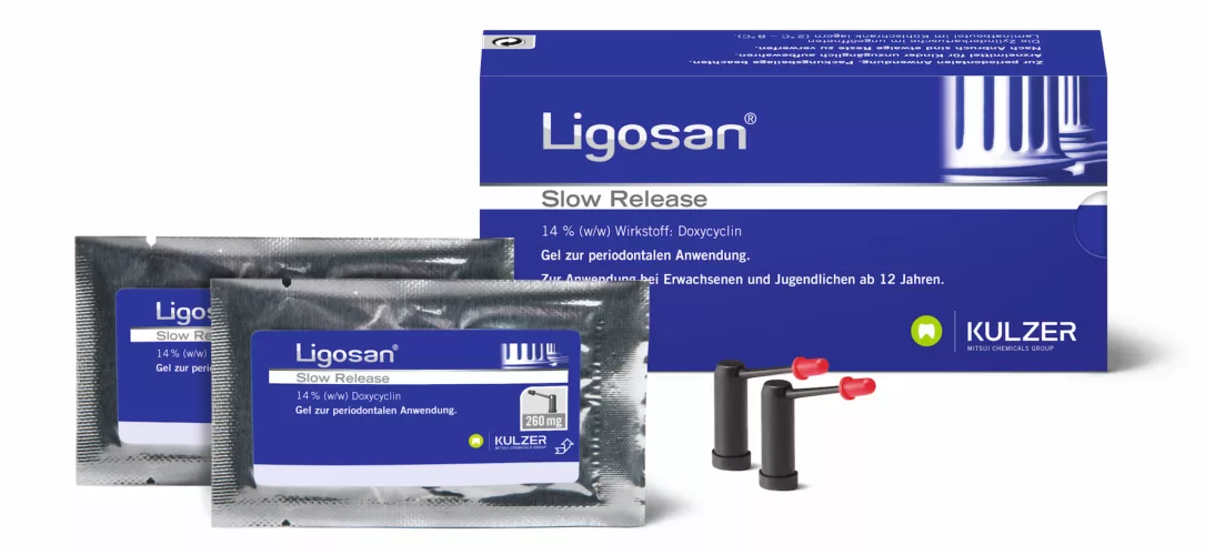 Im Rahmen der UPT setzt Dr. Matthias Lotz bei Rezidiven und Taschen mit Sondierungstiefen von mehr als 5 mm Ligosan Slow Release ein.