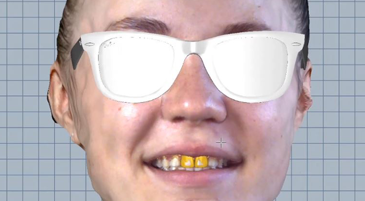 Abb. 2: Herstellung eines digitalen Wax-ups. f: Überlagerung des Wax-ups mit dem Facescan.