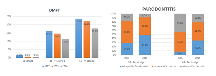 Abb. 1: DMFT-Werte in den Jahren 1997, 2005 und 2014 in verschiedenen Altersgruppen sowie die Parodontitisprävalenz bei Erwachsenen in den Jahren 2005 und
2014. Die Daten stammen aus [11].