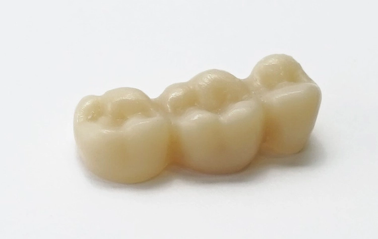 Abb. 19: Optimales und perfekt ausgearbeitetes Provisorium, das sowohl ästhetische als auch funktionelle Anforderungen erfüllt.