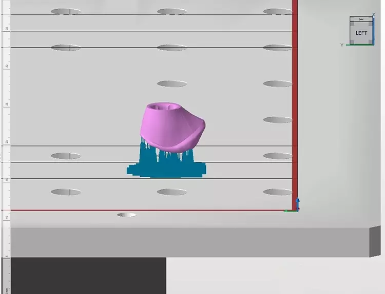 Abb. 4: Ausgerichteter und mit Stützstrukturen versehener Gingivaformer für die additive Fertigung mittels
3D-Druck.