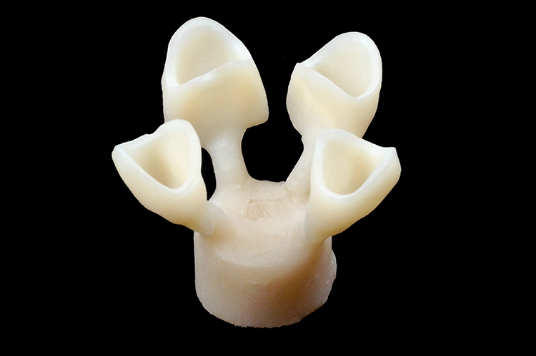 Abb. 4: 4 Kronen aus VITA Ambria – gepresst mit einem L-Pellet.