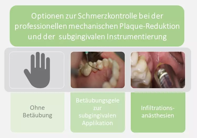 Abb. 4: In-Office-Optionen zur Schmerzkontrolle bei der systematischen
Parodontitistherapie [11].