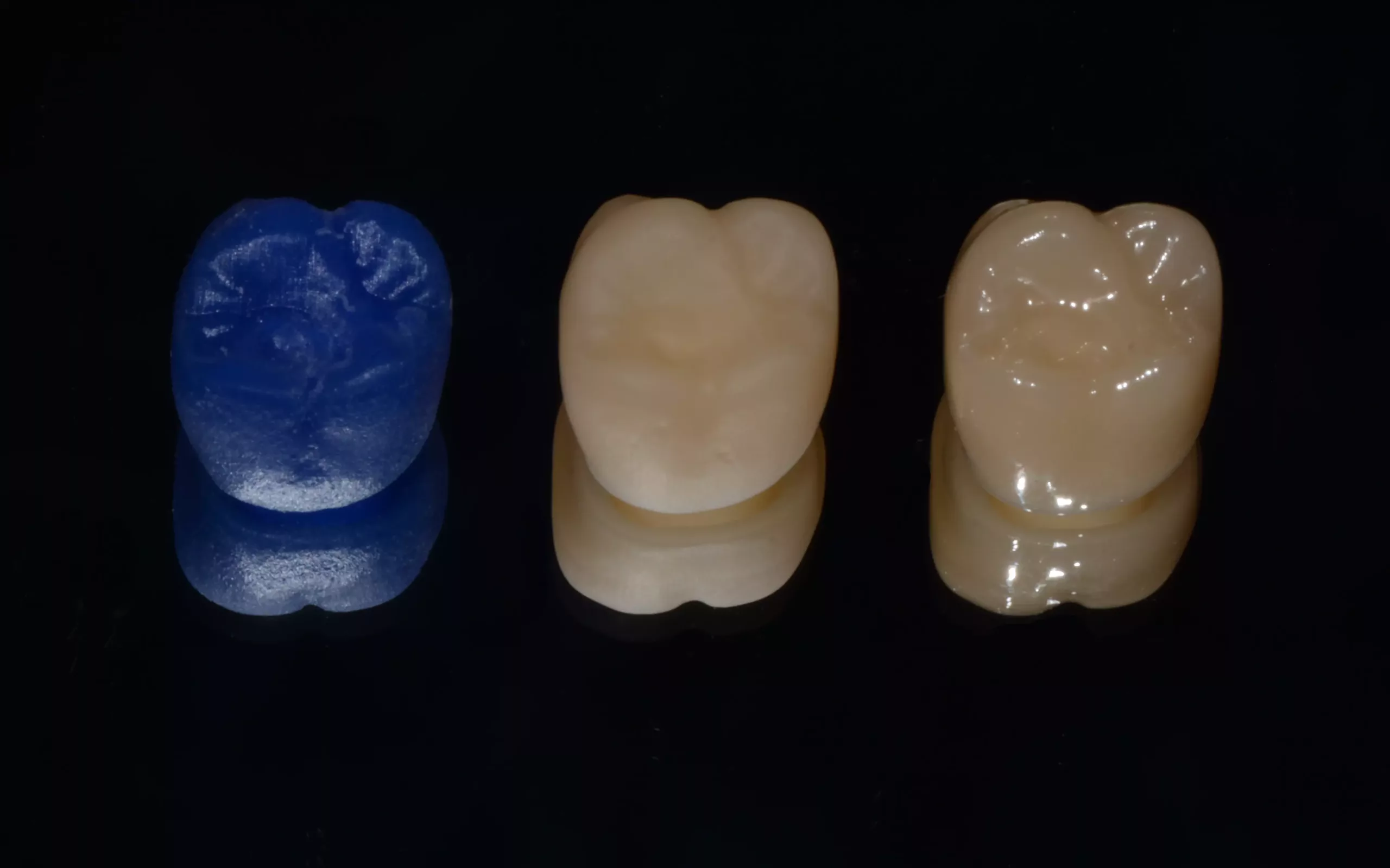 Abb. 6: Krone: gedruckt aus Castable Resin (links), gepresst (Mitte) und mit Glanzbrand (rechts).