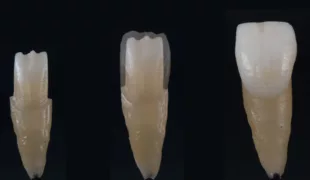Wie die Tripple Layering Technique (TLT©) funktioniert, erfahren die Teilnehmer unter anderem im Rahmen des Kurses von Björn Maier.