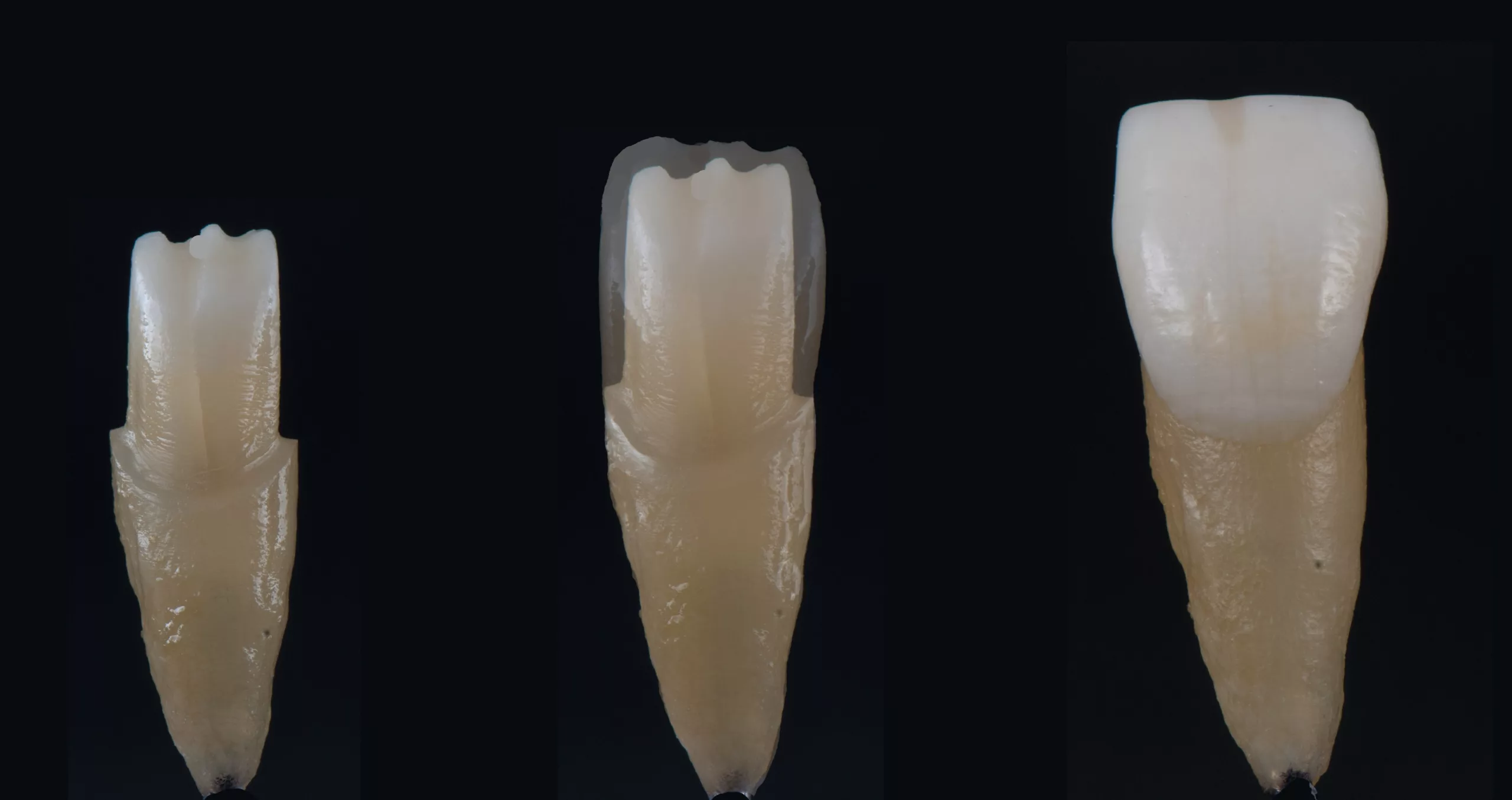 Wie die Tripple Layering Technique (TLT©) funktioniert, erfahren die Teilnehmer unter anderem im Rahmen des Kurses von Björn Maier.
