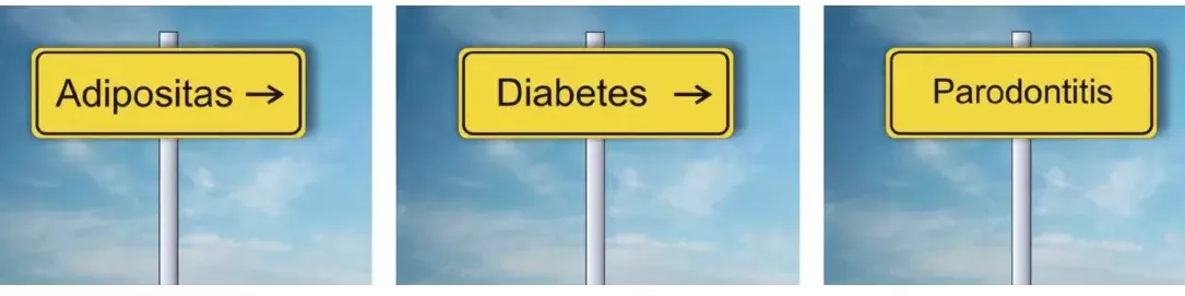 Indirekter Einfluss von Adipositas auf Parodontitis über Diabetes mellitus.