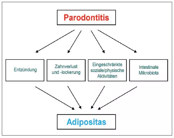 Abb. 4: Möglicher Einfluss von Parodontitis auf Adipositas.