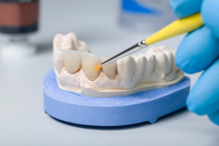 Aligner Therapie