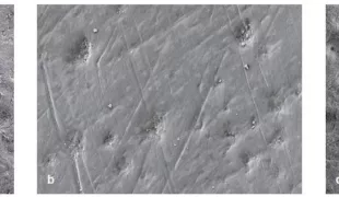 Abb. 1a–c: Schmelzoberfläche mit Biofilmresten vor der Reinigung (a), nach Politur mit gering abrasiver Paste/weichem Polierkelch (b: Cleanic, RDA-Wert 27/Pro-Cup Soft, beide KerrHawe) und mit Erythritol-Pulver (c: AIRFLOW® PLUS Pulver, E.M.S.).