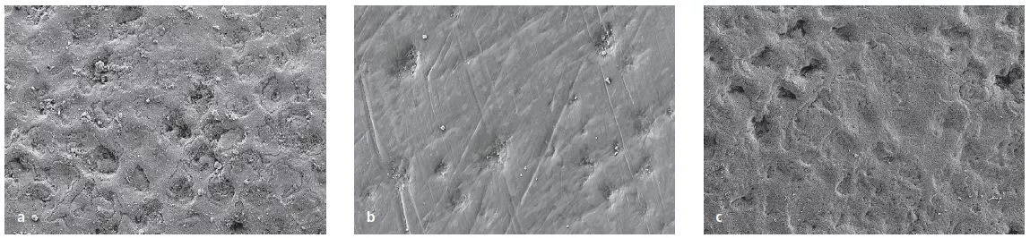 Abb. 1a–c: Schmelzoberfläche mit Biofilmresten vor der Reinigung (a), nach Politur mit gering abrasiver Paste/weichem Polierkelch (b: Cleanic, RDA-Wert 27/Pro-Cup Soft, beide KerrHawe) und mit Erythritol-Pulver (c: AIRFLOW® PLUS Pulver, E.M.S.).