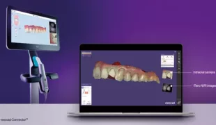 „Mit dem iTero-exocad Connector ist das Zurücksenden von Scans ans Labor unkompliziert möglich“, so Dr. Ingo Baresel.