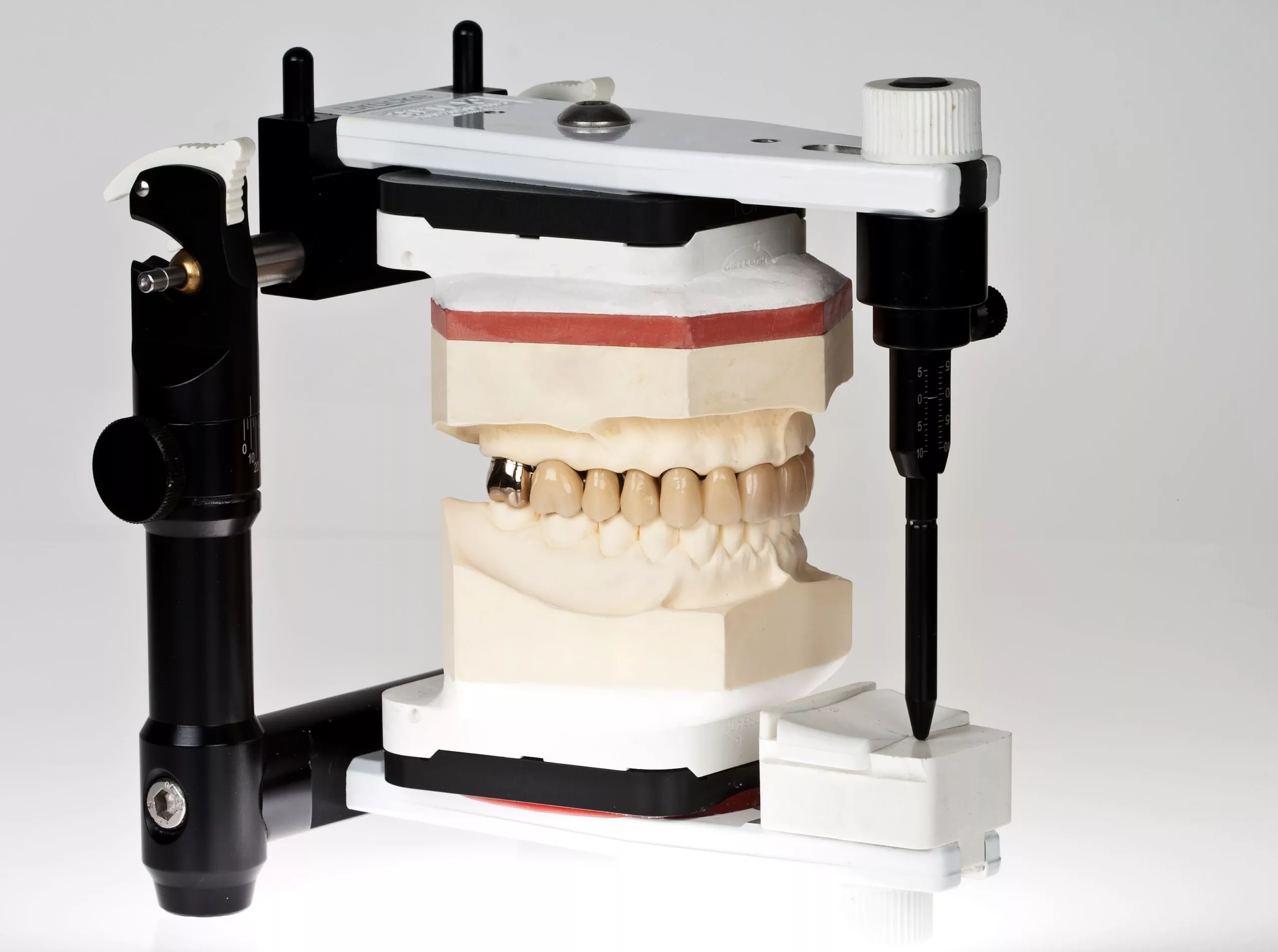 Für das zweite Quartal 2017 ist im Zahntechniker-Handwerk ein Umsatzrückgang gegenüber dem entsprechenden Vorjahresquartal in Höhe von -1,3 Prozent zu verzeichnen