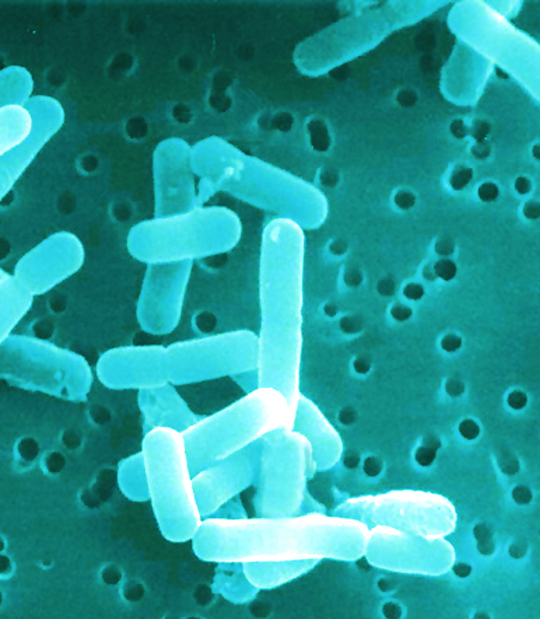 Abb. 1: Die gesunden Milchsäurebakterien Lactobacillus reuteri.