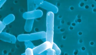 Lactobacillus reuteri Prodentis.